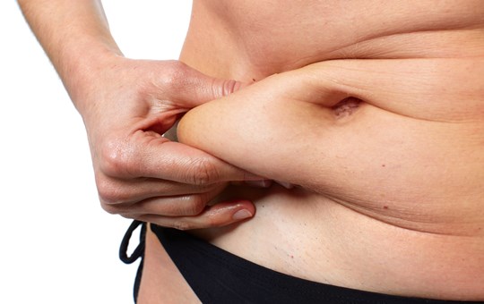 Body Contouring - Tummy Tuck (Abdominoplasty)