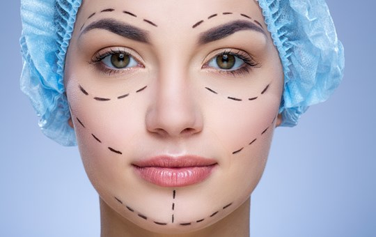 Face Lift and Neck lift (Rhytidectomy)