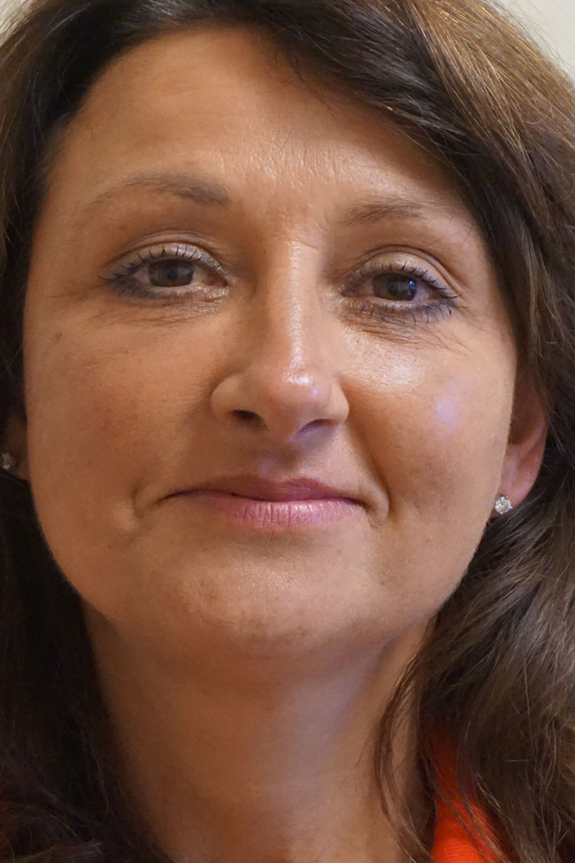 Facelift Post 11.jpg