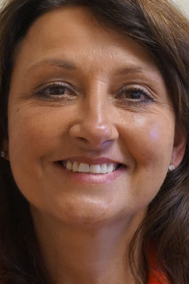 Facelift Post 12.jpg